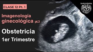 121  Imagen en Obstetricia 1er Trimestre [upl. by Nellahs353]