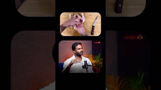 Skinless vs SkinOn Which Chicken Wins  Telugu Podcast  Voice of Mogasala [upl. by Behnken]