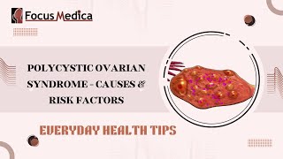 Polycystic Ovarian Syndrome Causes amp Risk factors [upl. by Sum803]