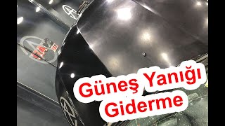 Güneş Yanığı Giderme Uygulaması [upl. by Nosidam]