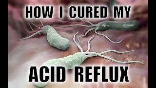 How I cured my Acid Reflux and Helicobacter Pylori infection without antibiotics [upl. by Lukas778]