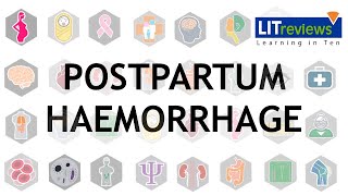 Prevention and Treatment of Postpartum Haemorrhage [upl. by Ymmac]