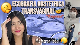 ECOGRAFIA OBSTETRICA TRANSVAGINAL😱Mi experiencia🫣 STORYTIME  EMBARAZADA A LOS 17  Soy Andreaa [upl. by Solegna914]