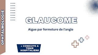 Glaucome aigue par fermeture de langle Rappel physiopathologie formes cliniques DC positif CAT [upl. by Murat]