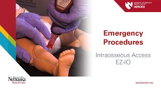 Emergency Procedures Intraosseous Access  EZIO [upl. by Glenine]