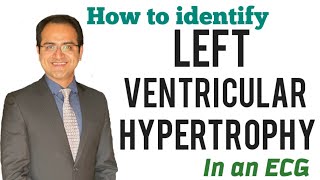 Left Ventricular Hypertrophy ECG Changes Skolow Lyon Criteria Explained ECG Lectures USMLE NEETPG [upl. by Garnes]