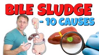 What Causes Poor Bile Flow and Gallbladder Sludge [upl. by Jovia17]