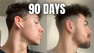 How To GROW A BEARD In 90 Days Using MINOXIDIL amp DERMA ROLLER [upl. by Vandyke]