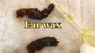 Earwax cerumen is yellowish waxy [upl. by Bonaparte]