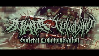 ACRANIA  VULVODYNIA  SOCIETAL LOBOTOMISATION OFFICIAL STREAM 2021 SW EXCLUSIVE [upl. by Dnomso]