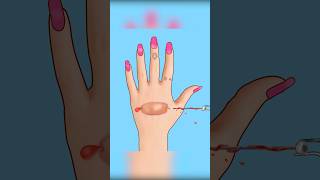 ASMR Treatment infected hand piercing asmr animation viral trending youtubeshorts shorts [upl. by Brantley]