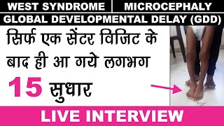 West Syndrome Recovery  Microcephaly Baby Treatment  Global Developmental Delay Case Presentation [upl. by Chlori]