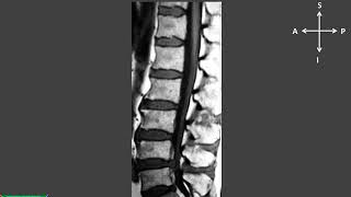 Vídeo 14✔️Física de la Resonancia Magnética 👍 Principios Físicos Magnetic Resonance imaging español [upl. by Ainoda]