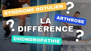 Syndrome rotulien chondropathie et arthrose Quelle différence [upl. by Airednaxela]