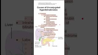 Causes of Unconjugated Hyperbilirubinemia [upl. by Scammon]