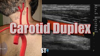 Carotid Duplex Exam [upl. by Eerual861]