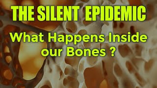 WHY bone health MATTERS  How to prevent OSTEOPOROSIS [upl. by Enelyw980]