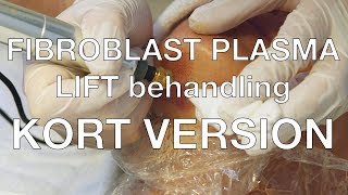 FIBROBLAST PLASMA LIFT behandling Kort Version [upl. by Ami]