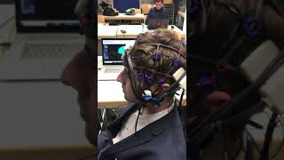 EEG 40 Hz Gamma induced by Vielight NeuroGamma Photobiomodulation for Neurofeedback [upl. by Shakespeare469]