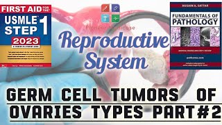 USMLE step1Ovarian Cancer part 2 Sexcord stromal tumors from First AidRepro PathUrduHindi [upl. by Pascale]