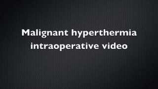 Malignant Hyperthermia Intraoperative video  Case Report [upl. by Rimas]