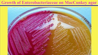 How to Prepare a batch of Petri Plates from Dehydrated Culture Media [upl. by Ellenaej824]