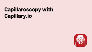 Tutorial How to perform Capillaroscopy with Capillaryio [upl. by Jotham]