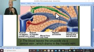 Hepatic disorders in Arabic 1  Bilharzial periportal fibrosis  by Dr Wahdan [upl. by Julina]