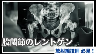 【レントゲンのトリカタ講座】現役放射線技師が股関節のレントゲン撮影を解説します！pert1 [upl. by Shu]