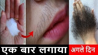 5 मिनट में अनचाहे के बालों को ऐसे हटाएगा की दोबारा आना भूल जायेंगे Permanently Remove Unwanted Hair [upl. by Urata]