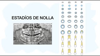 ESTADÍOS DE NOLLA 🦷✅ Desarrollo de dientes permanentes [upl. by Ditter]