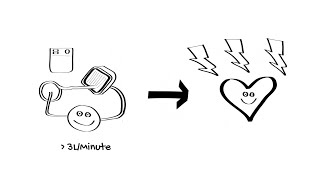 Introduction to ECMO Part 4  ECPR ECMO CPR [upl. by Derte969]