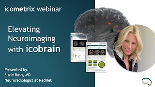 webinar  Elevating Neuroimaging with icobrain by Suzie Bash MD  November 2019 [upl. by Esened]