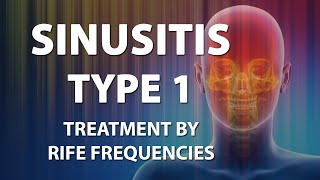 Sinusitis Type 1  RIFE Frequencies Treatment  Energy amp Quantum Medicine with Bioresonance [upl. by Enyaht]