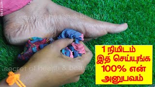 1 நிமிடத்தில் பாதவலி பாத எரிச்சல் காணாமல் போக இதை செய்யுங்க  patha vali tips in tamil  foot pain [upl. by Ahsinad]