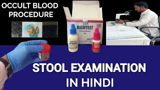 Stool Examination  Stool Microscopic Examination  माल की जांच  Stool Occult Blood Test [upl. by Douville]