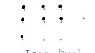 Understanding Total vs Free Phenytoin [upl. by Nisbet]