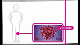 Venous Thrombosis Explained [upl. by Coates]