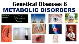 Genetical disease 6  Inborn Errors Of Metabolism  Phenylketonuria  Alkaptonuria  Albinism [upl. by Malha776]