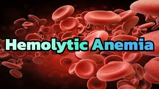 Hemolytic Anemia updated 2023  CRASH Medical Review Series [upl. by Kanor]