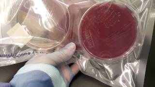 Microbiology Propionibacterium acnes anaerobic set up and colonial growth [upl. by Tade]