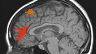 Anterior cingulate cortex [upl. by Nilre]