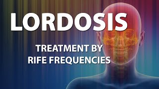 Lordosis  RIFE Frequencies Treatment  Energy amp Quantum Medicine with Bioresonance [upl. by Hamburger]