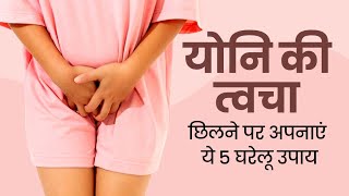 Natural Home Remedies to Get Rid from Itchy Private Parts  How to Treat Fungal Infections खुजली [upl. by Aridaj336]