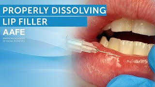 How To Dissolve Lip Filler  AAFE [upl. by Ecissej]