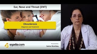 Otosclerosis  ENT Video Lectures  Medical Student Online Education  VLearning [upl. by Eelyr468]