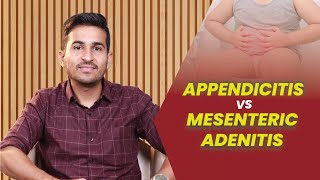 Appendicitis Vs Mesenteric Adenitis  Dr B Padam Kumar [upl. by Sibie]