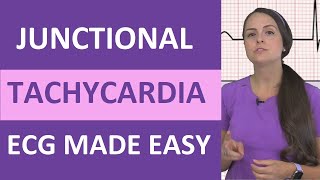 Junctional Tachycardia ECG Interpretation Made Easy for NCLEX Nursing School [upl. by Sadoc435]