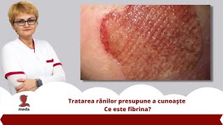 Tratarea ranilor presupune a cunoaste 👉 Ce este fibrina [upl. by Meurer]