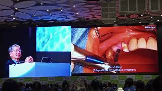 Dental Implant conference amp workshop with Animated vidoe [upl. by Kala150]